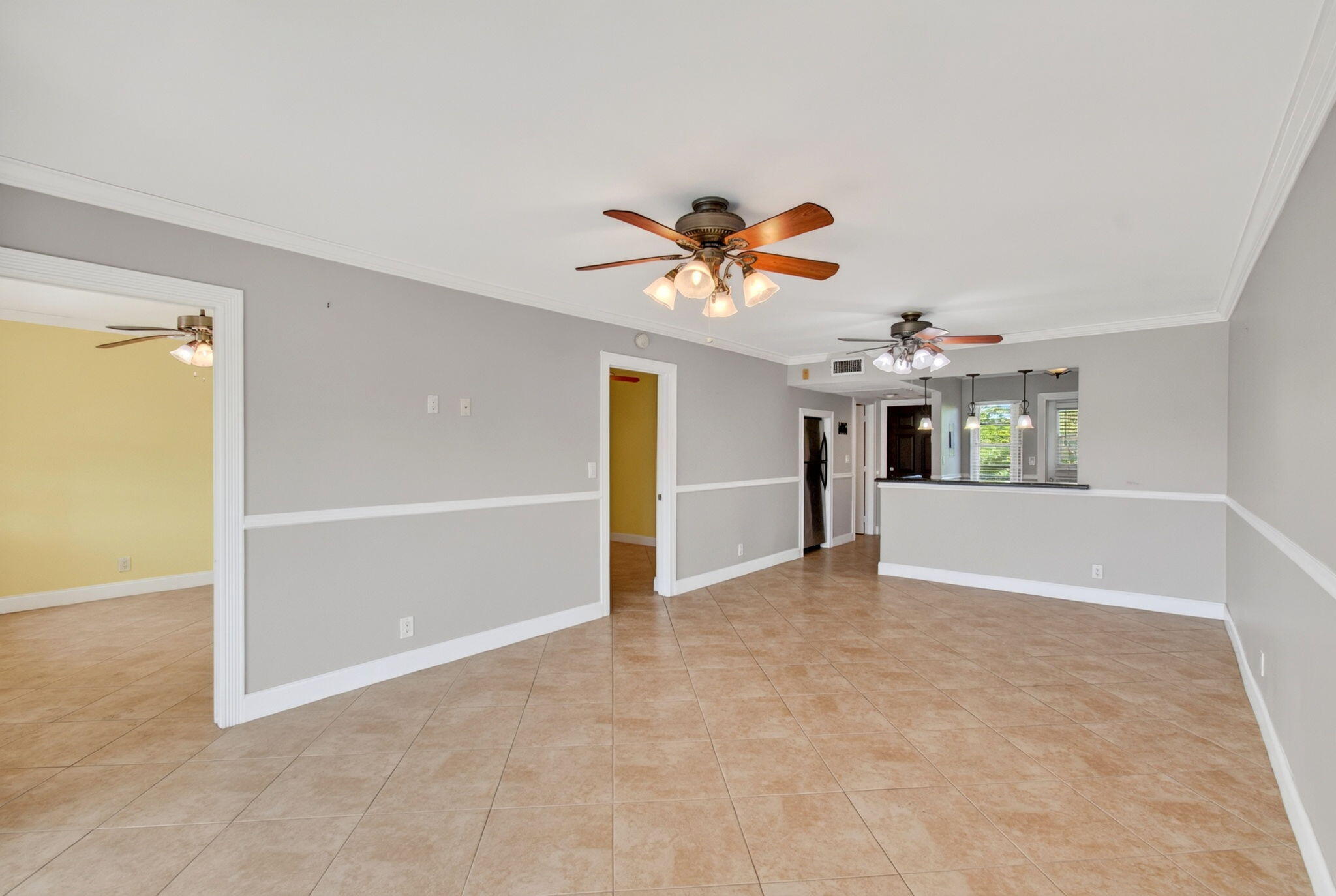 2871 N Ocean Boulevard N V345 Property Photo 10