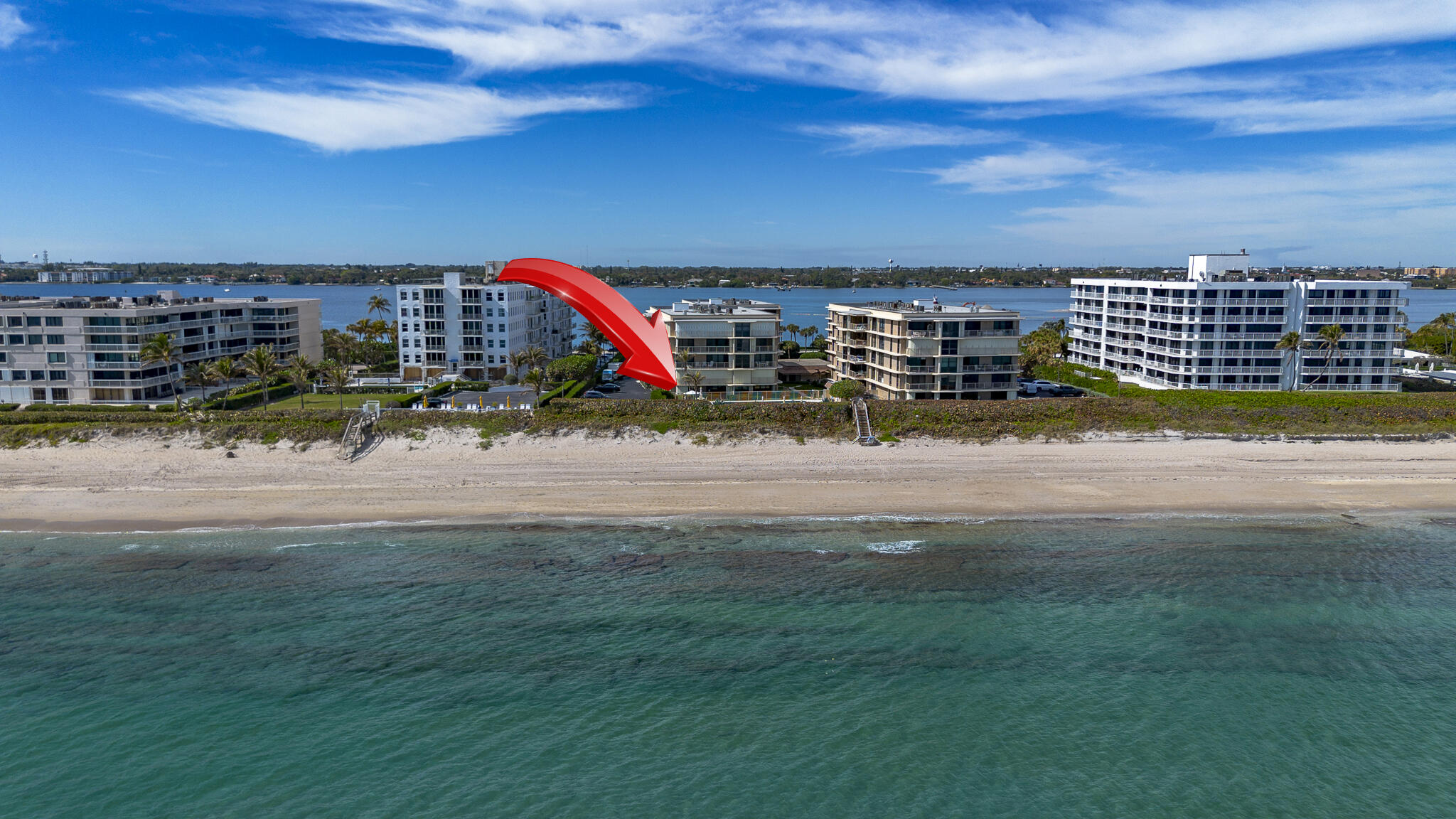 3200 S Ocean Boulevard A101 Property Photo 82