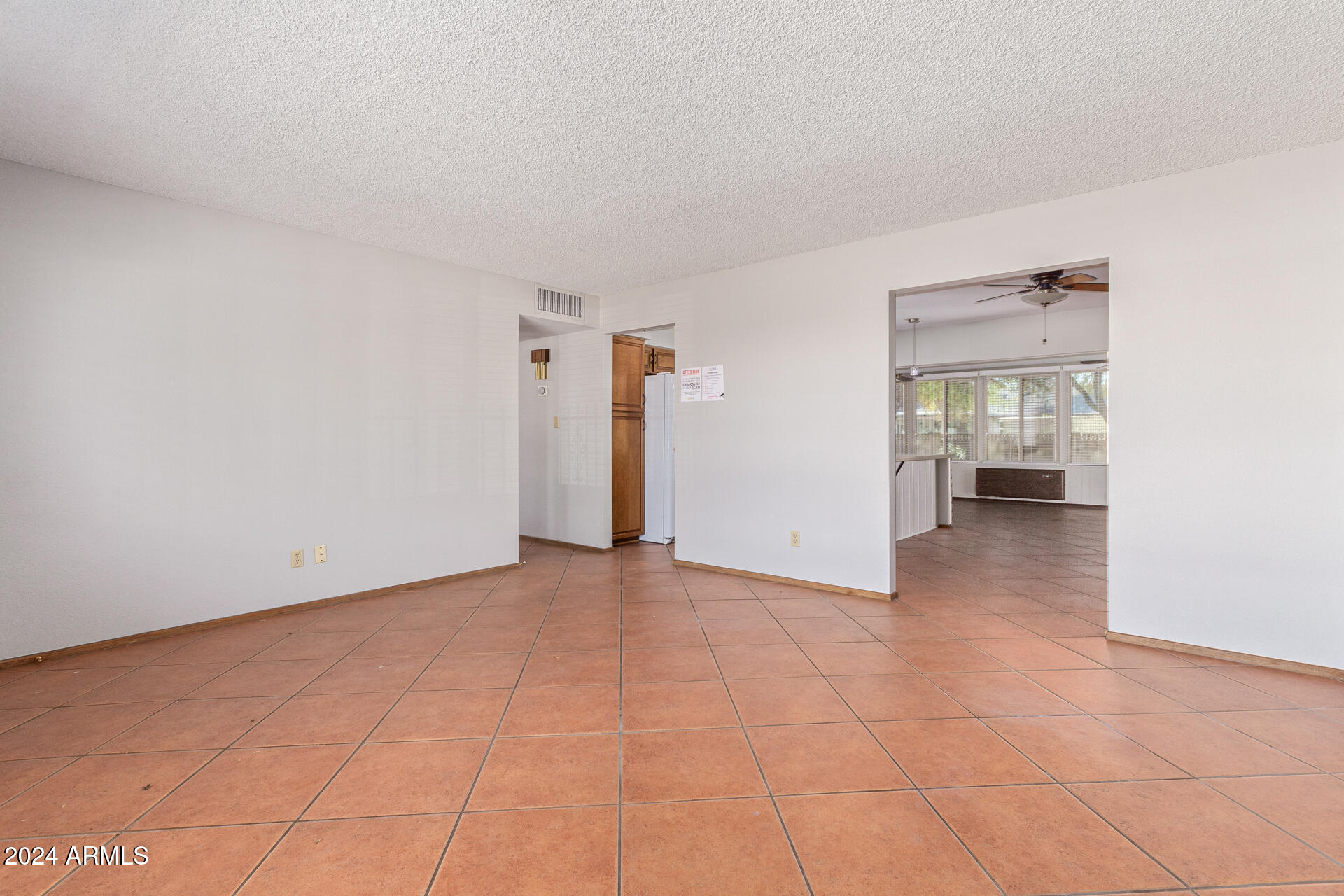 2407 W Laurel Lane Property Photo 5