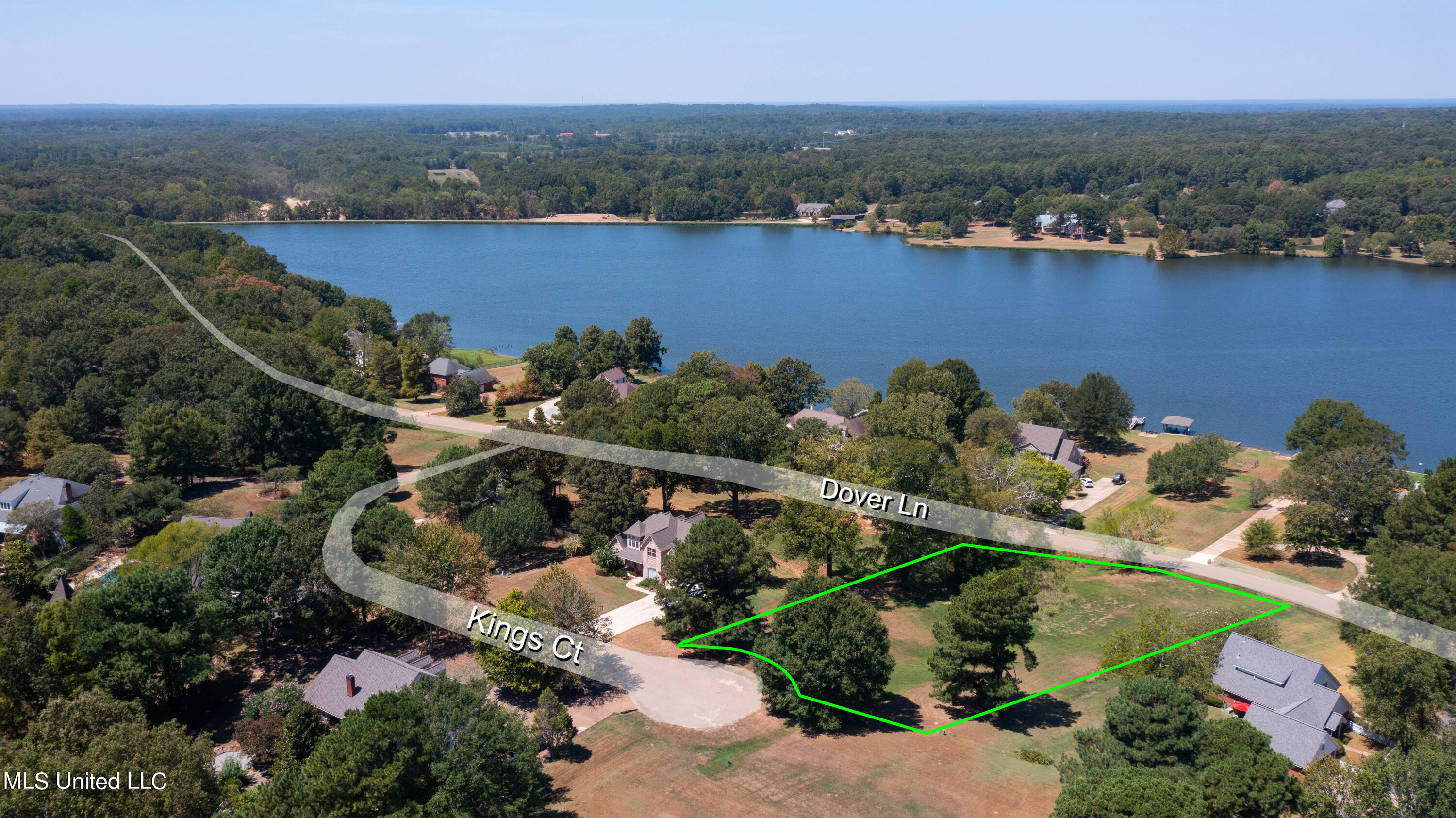 265 Dover Lane Property Photo 3