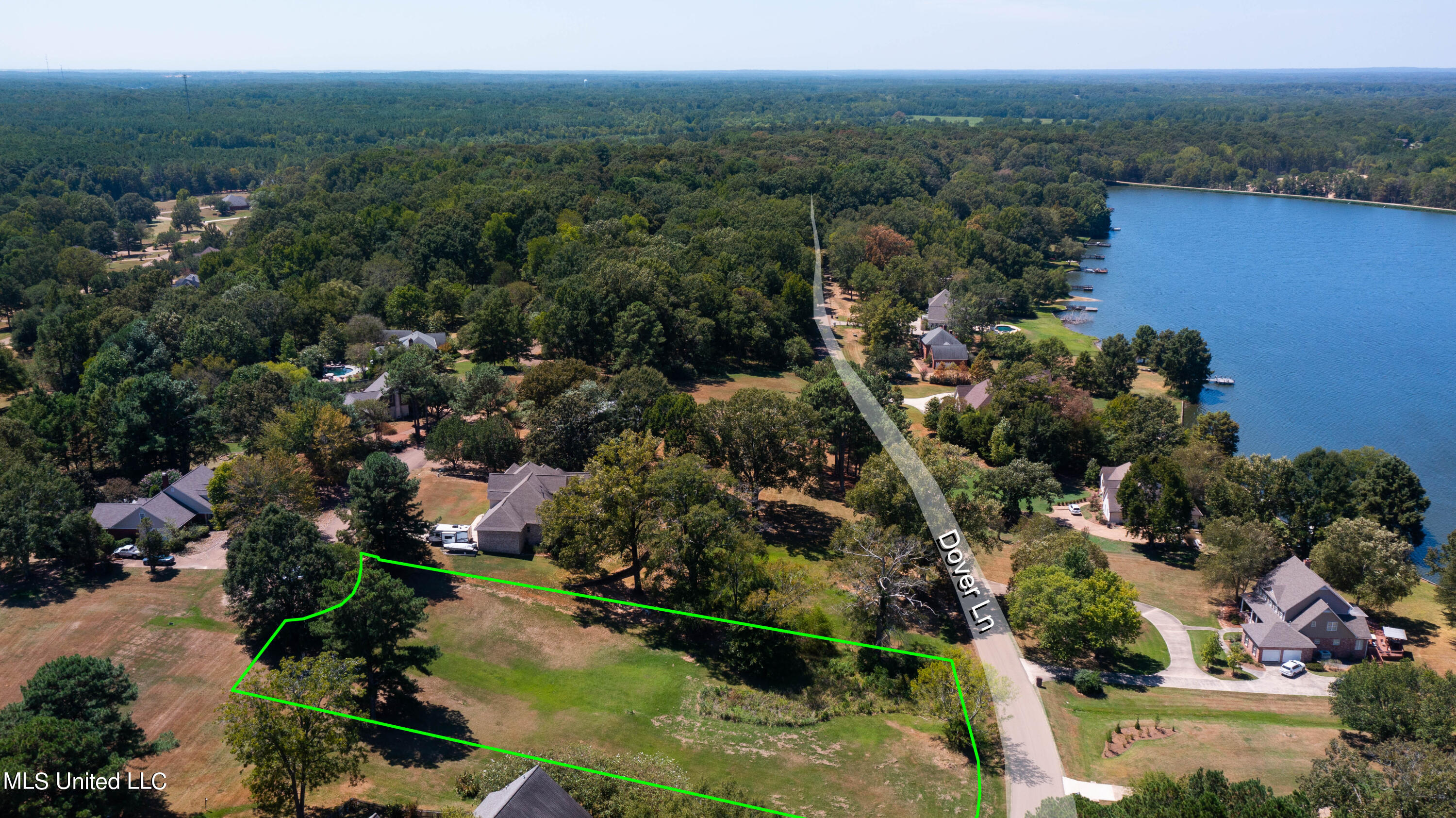 265 Dover Lane Property Photo 11