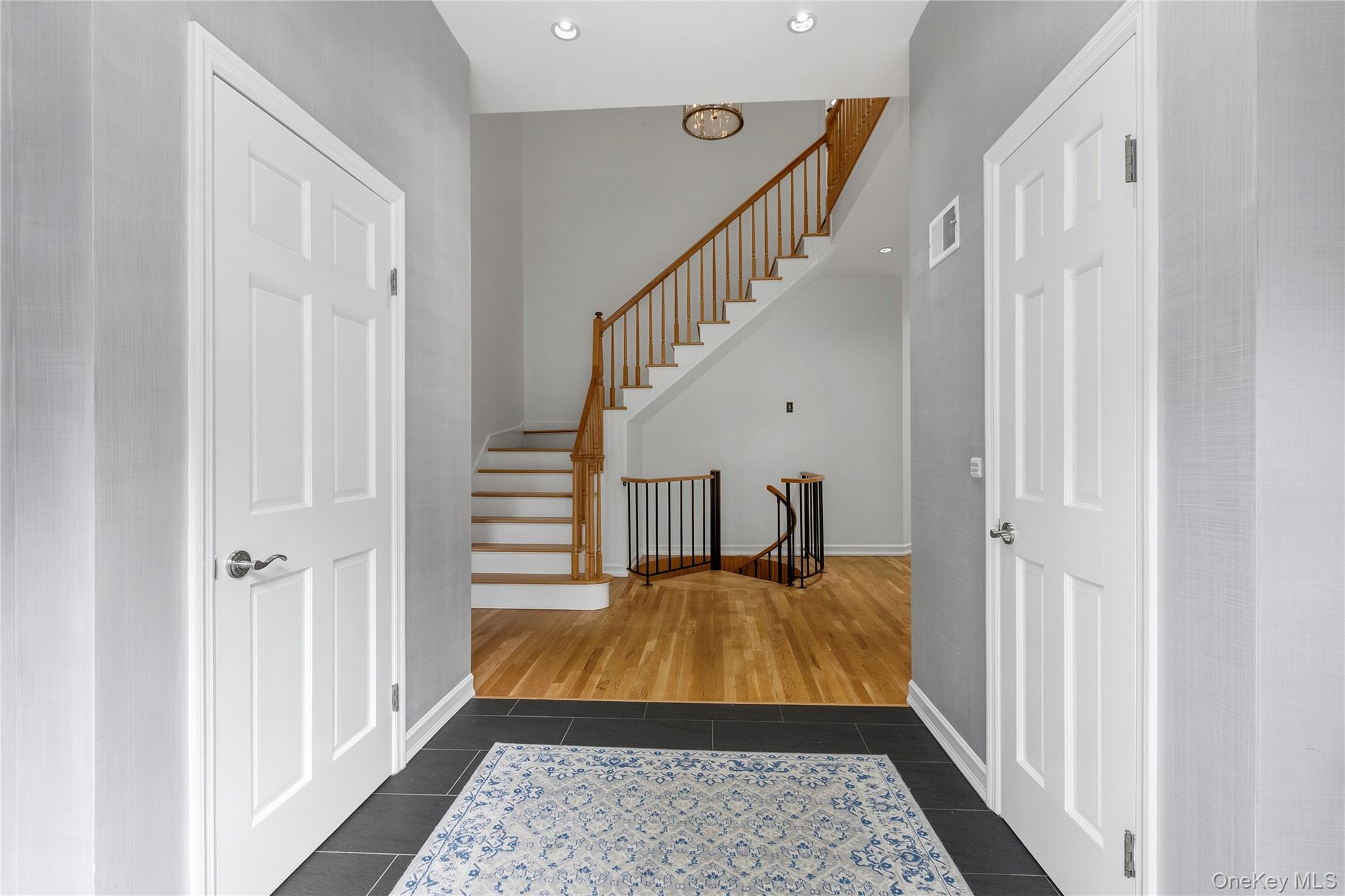 191 Beechmont Drive Property Photo 2