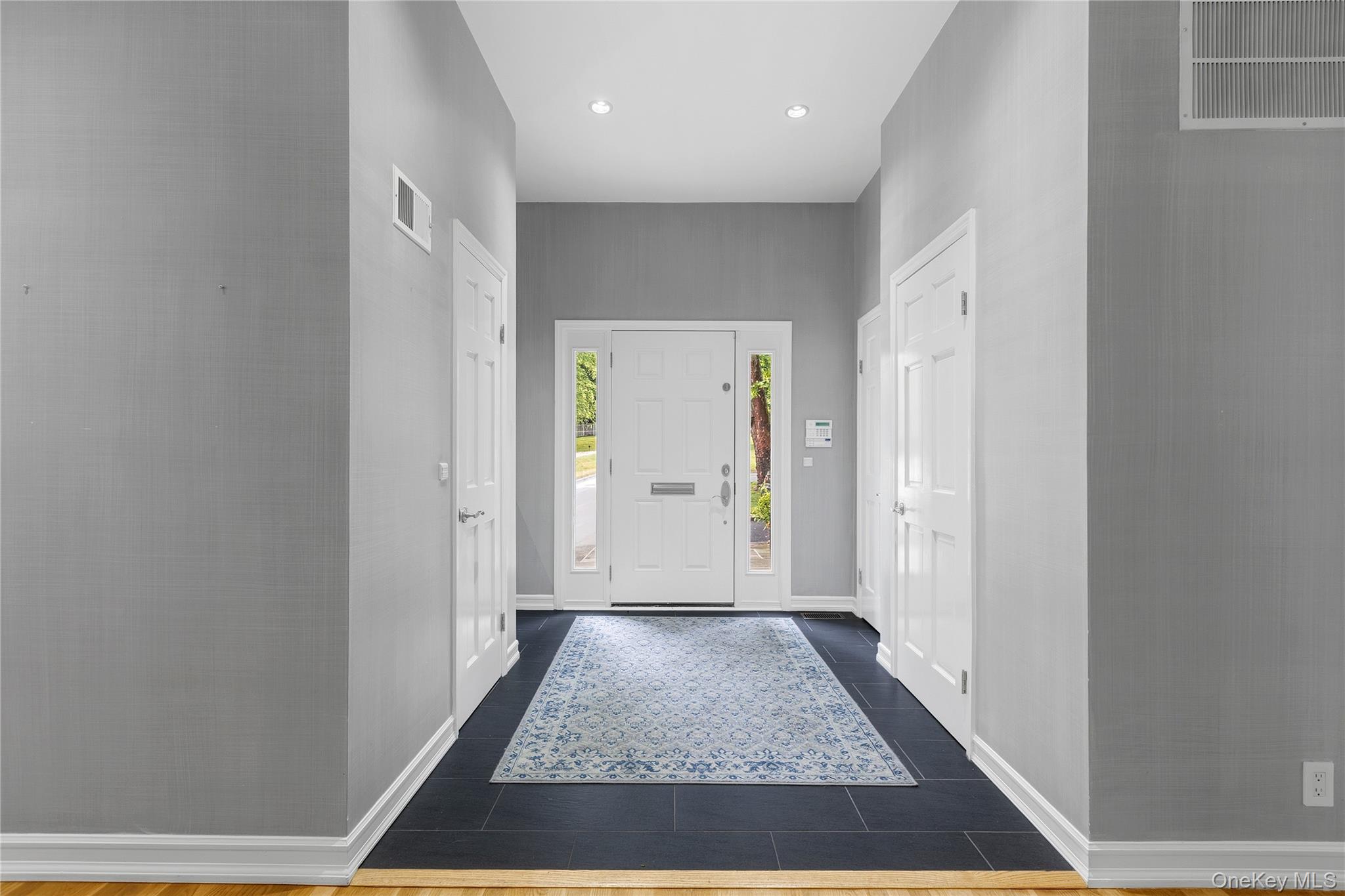 191 Beechmont Drive Property Photo 4