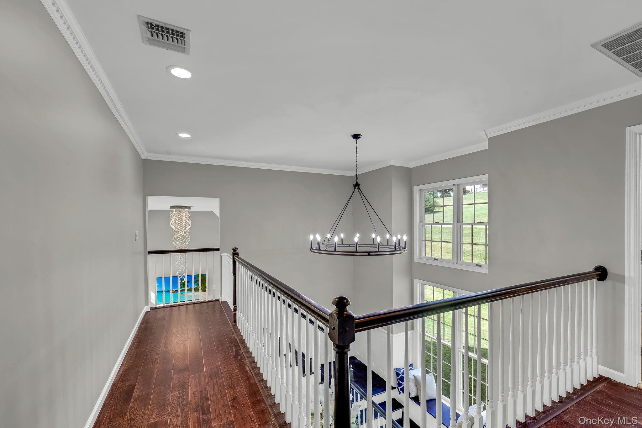 176 Beverly Road Property Photo 25