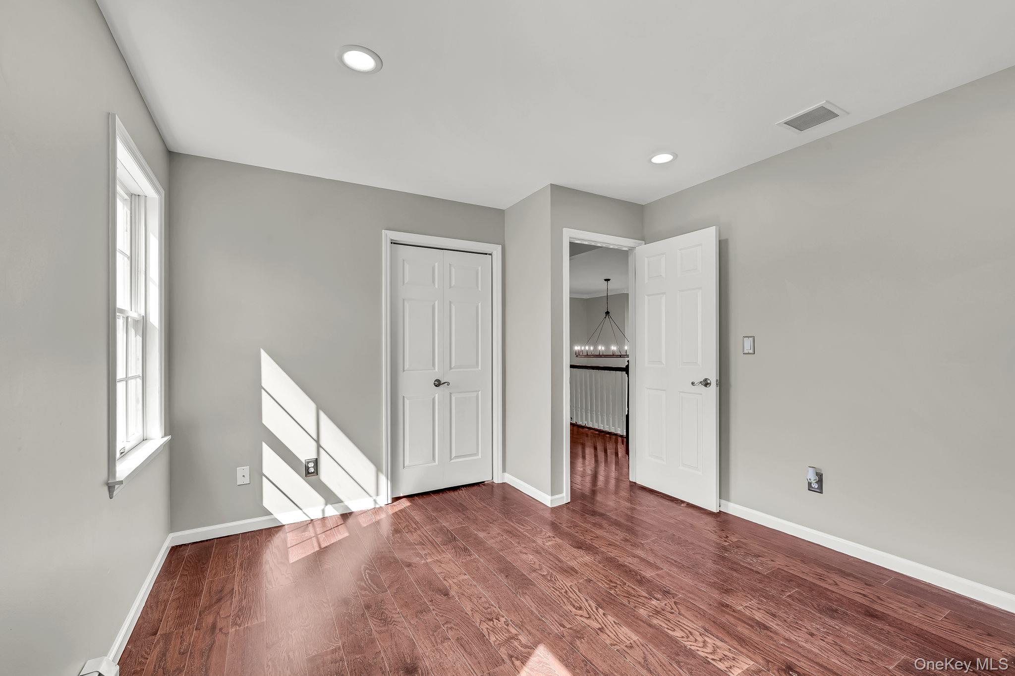 176 Beverly Road Property Photo 32