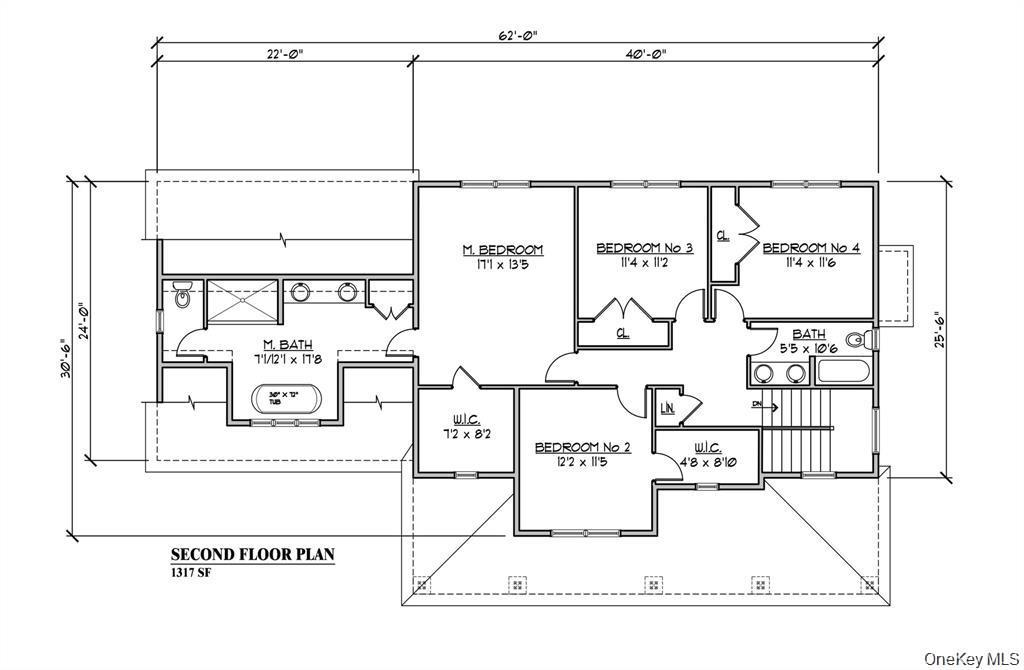 17 Sunset Lane Property Photo 34