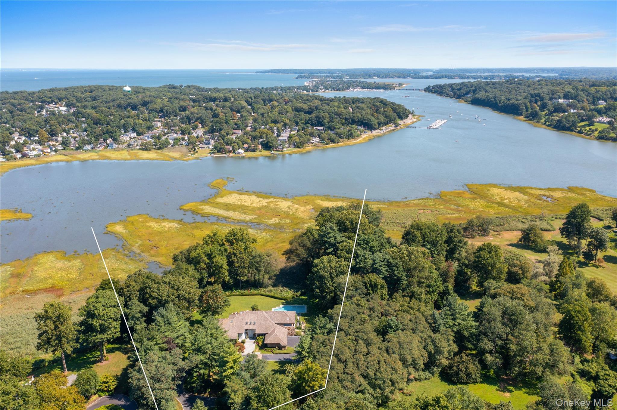 8 Mill Pond Lane Property Photo 3