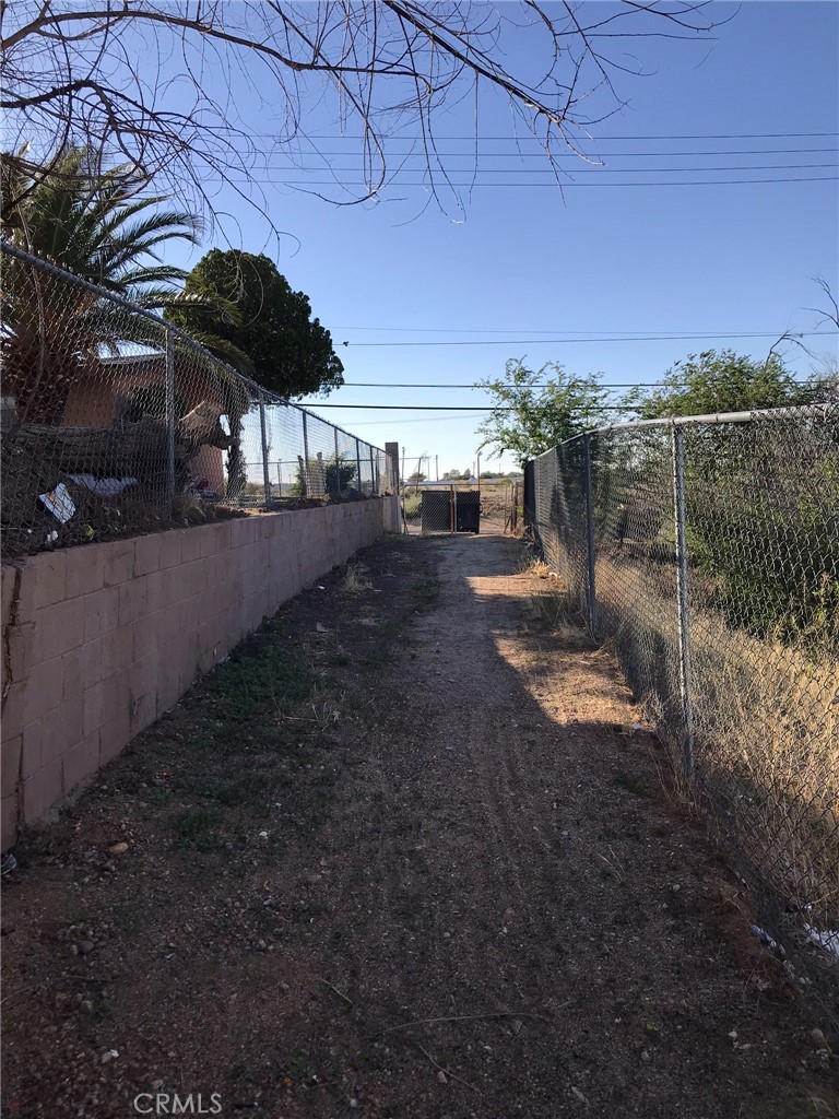 14904 7th Street Property Photo 31