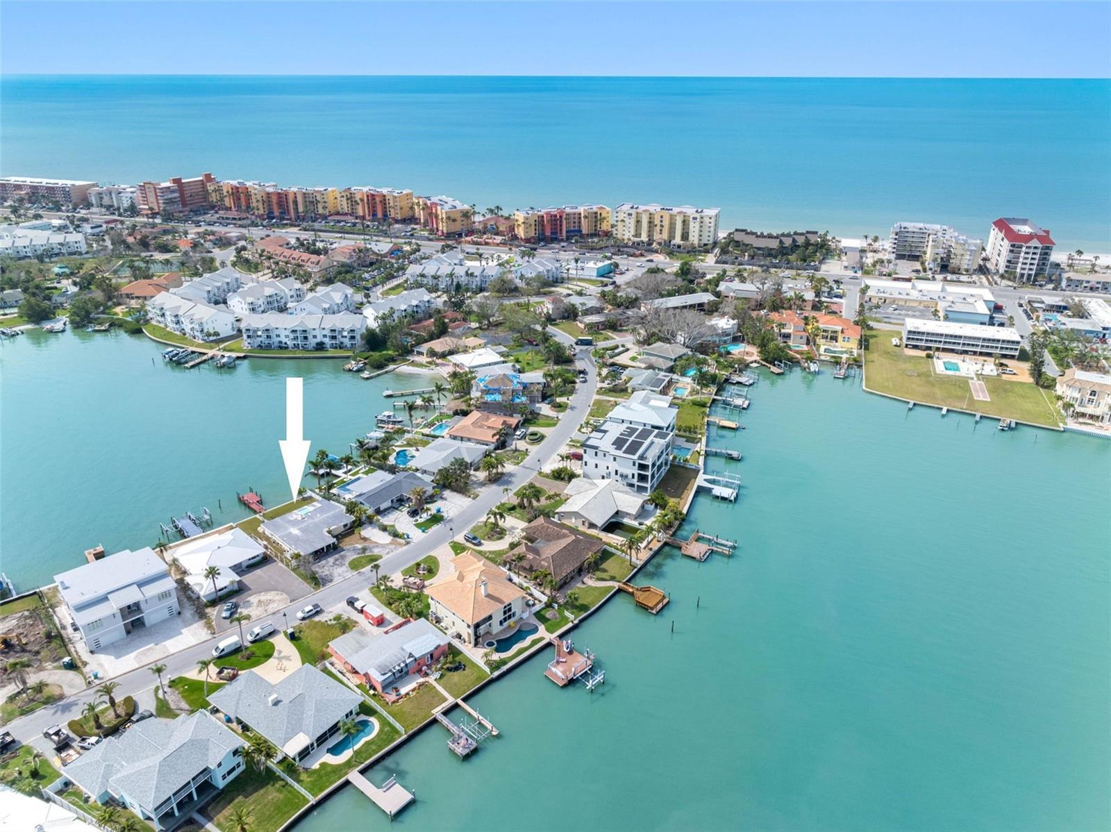 203 Bath Club Blvd N Property Photo