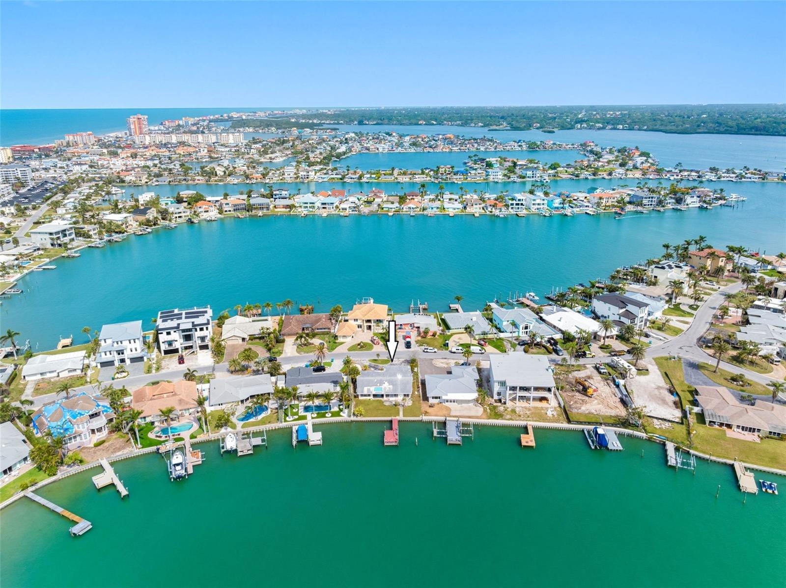 203 Bath Club Blvd N Property Photo