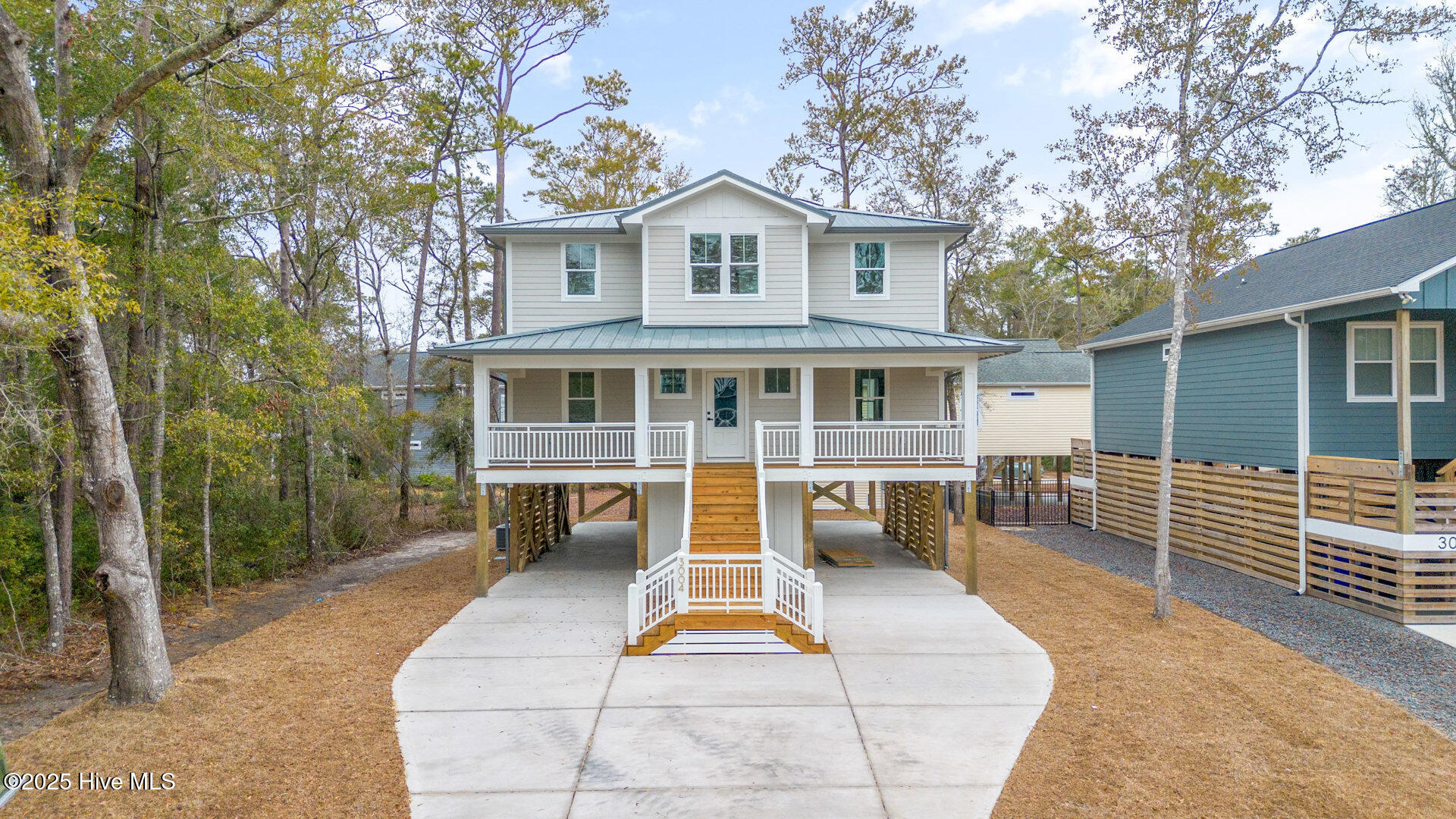 3004 W Oak Island Drive Property Photo 3