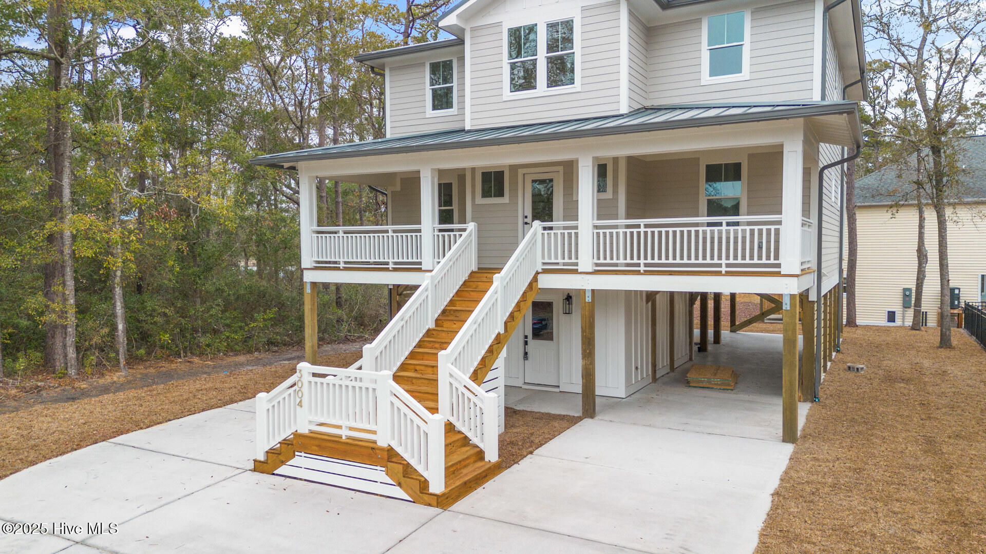 3004 W Oak Island Drive Property Photo 5