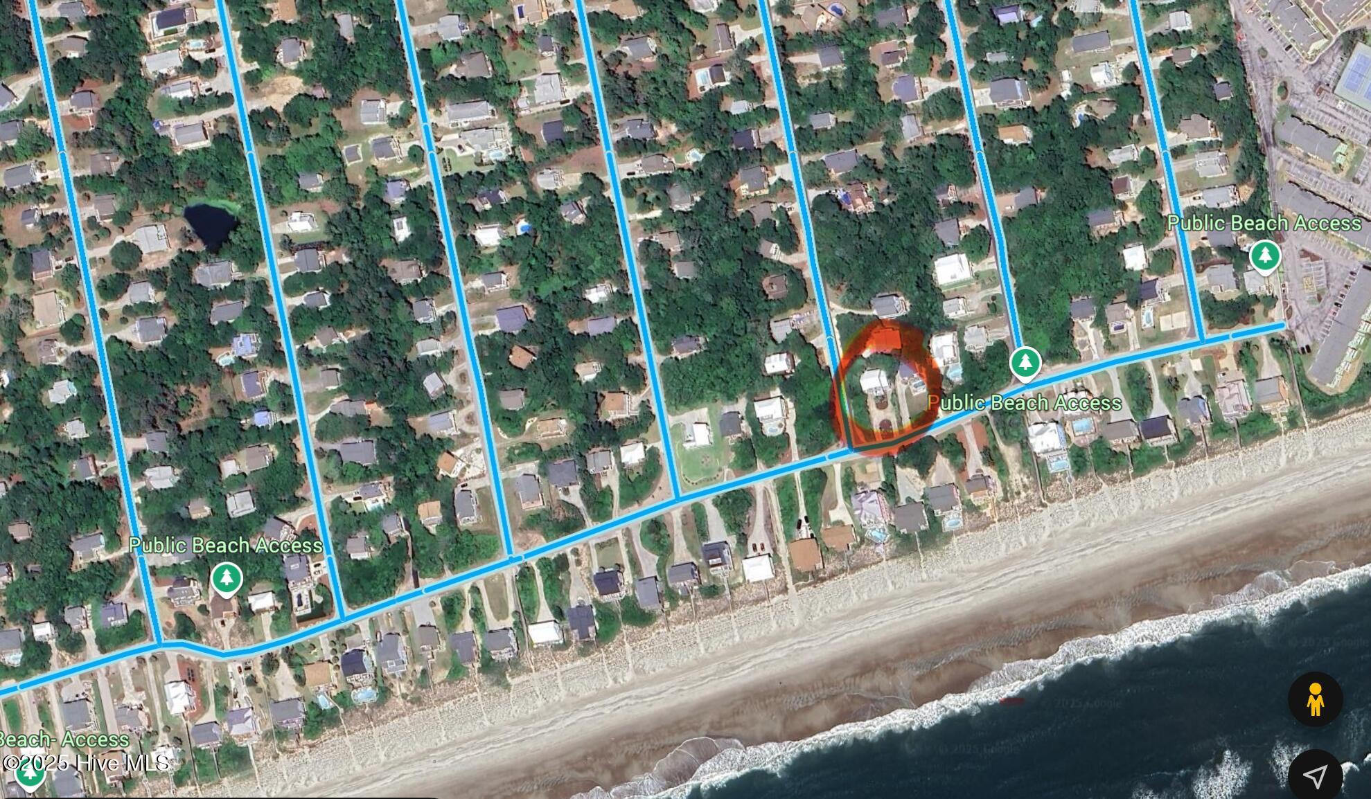 9308 Ocean Drive E & W Property Photo 11