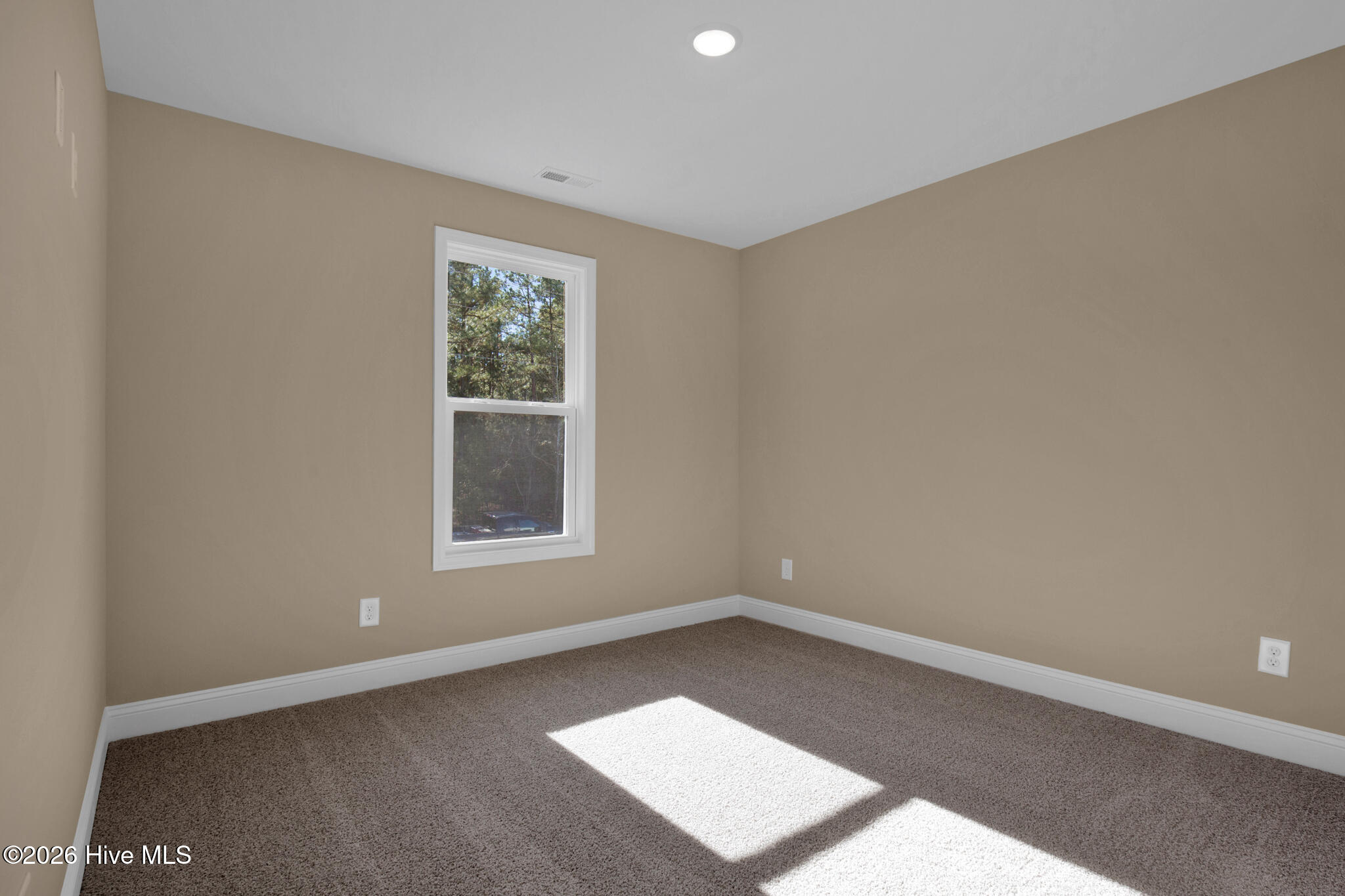 161 Merle Road Property Photo 30
