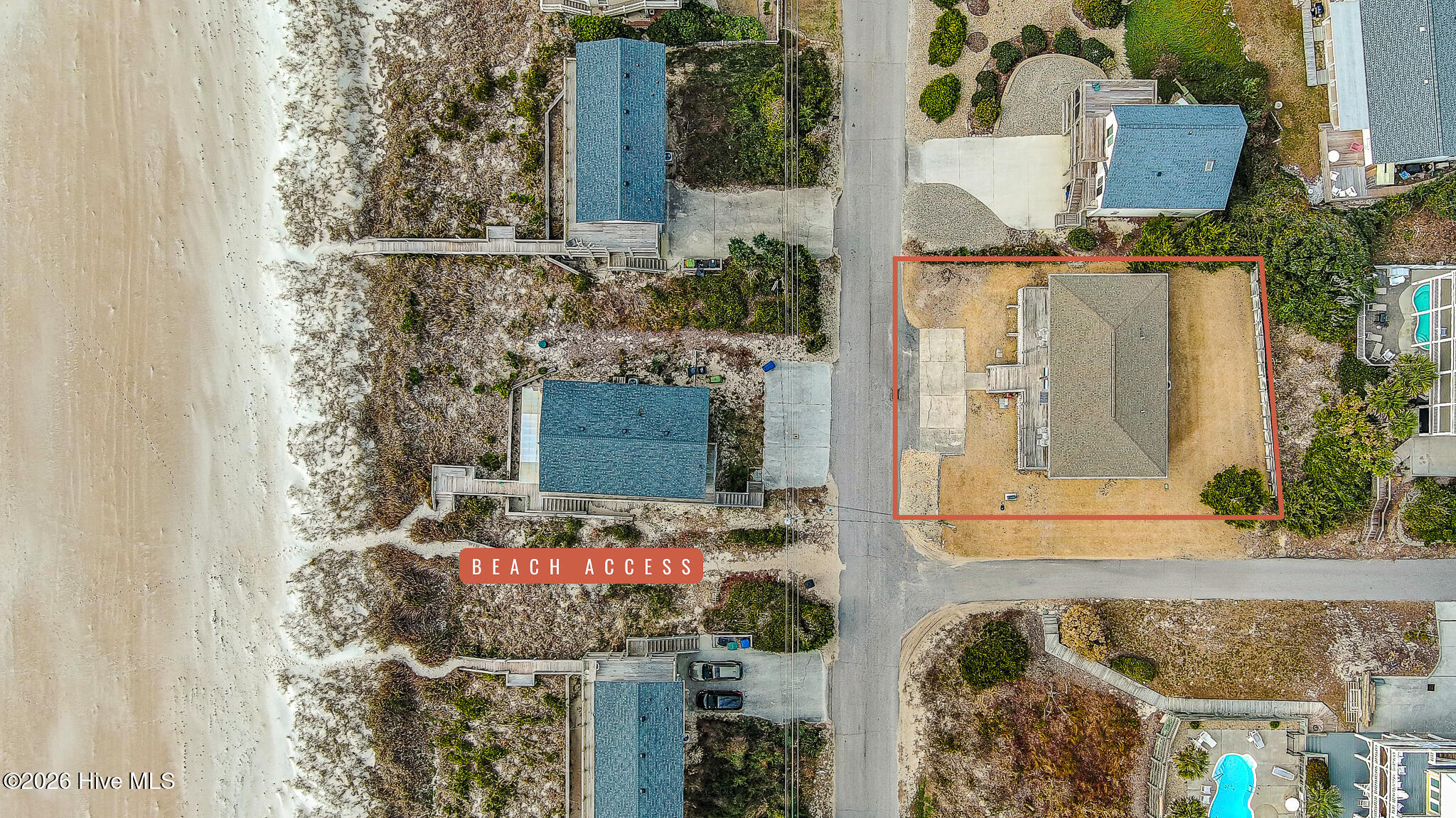 902 Ocean Drive E&w Property Photo 11
