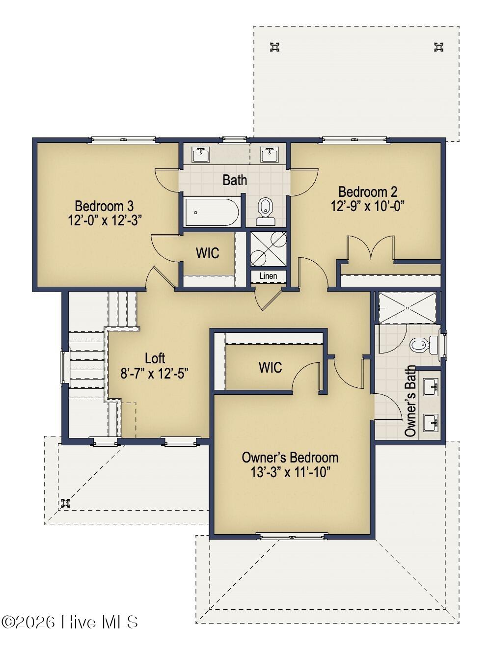 113 Carver Street 17 Property Photo 3