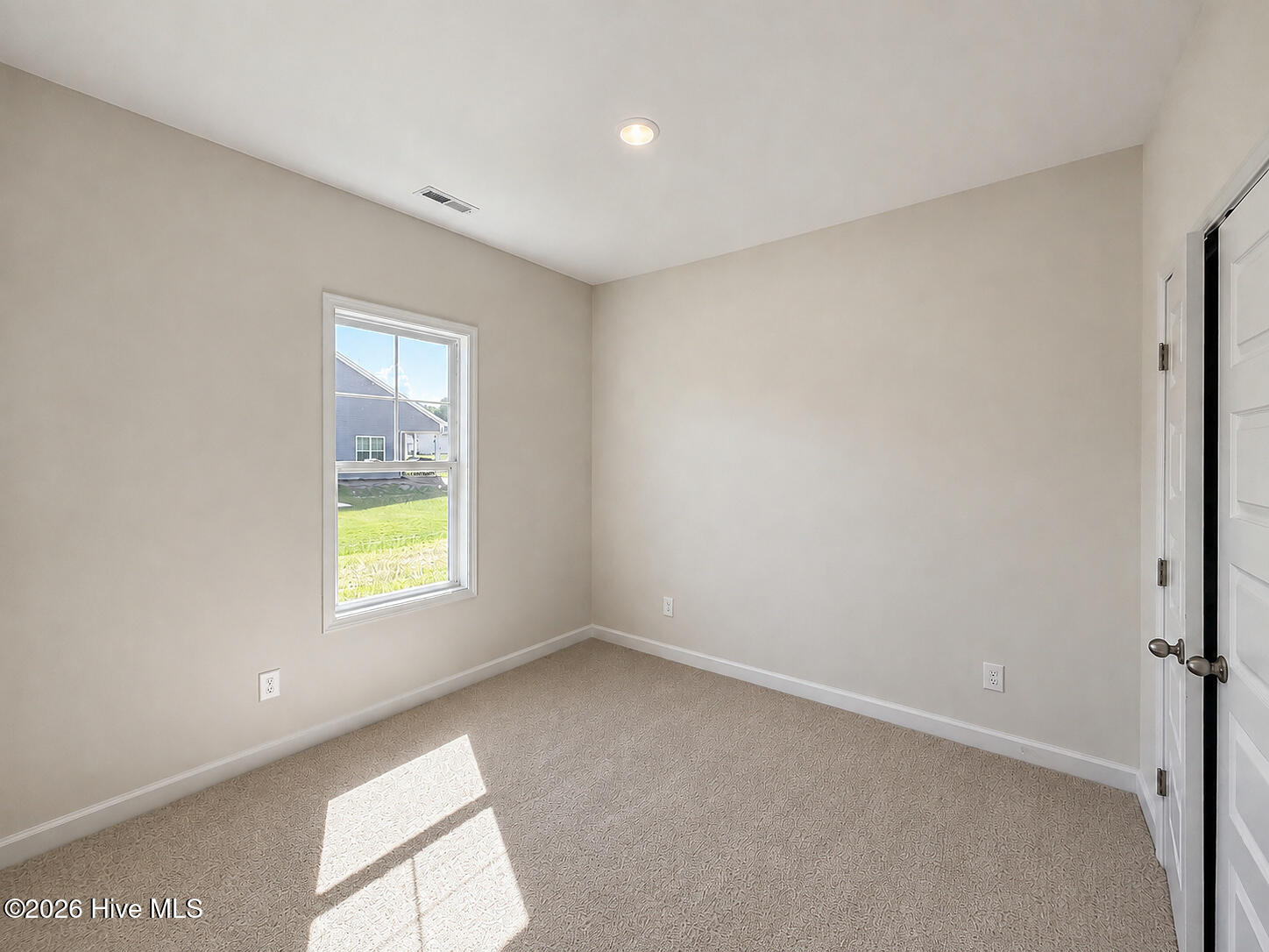 84 Yardley Drive Property Photo 14