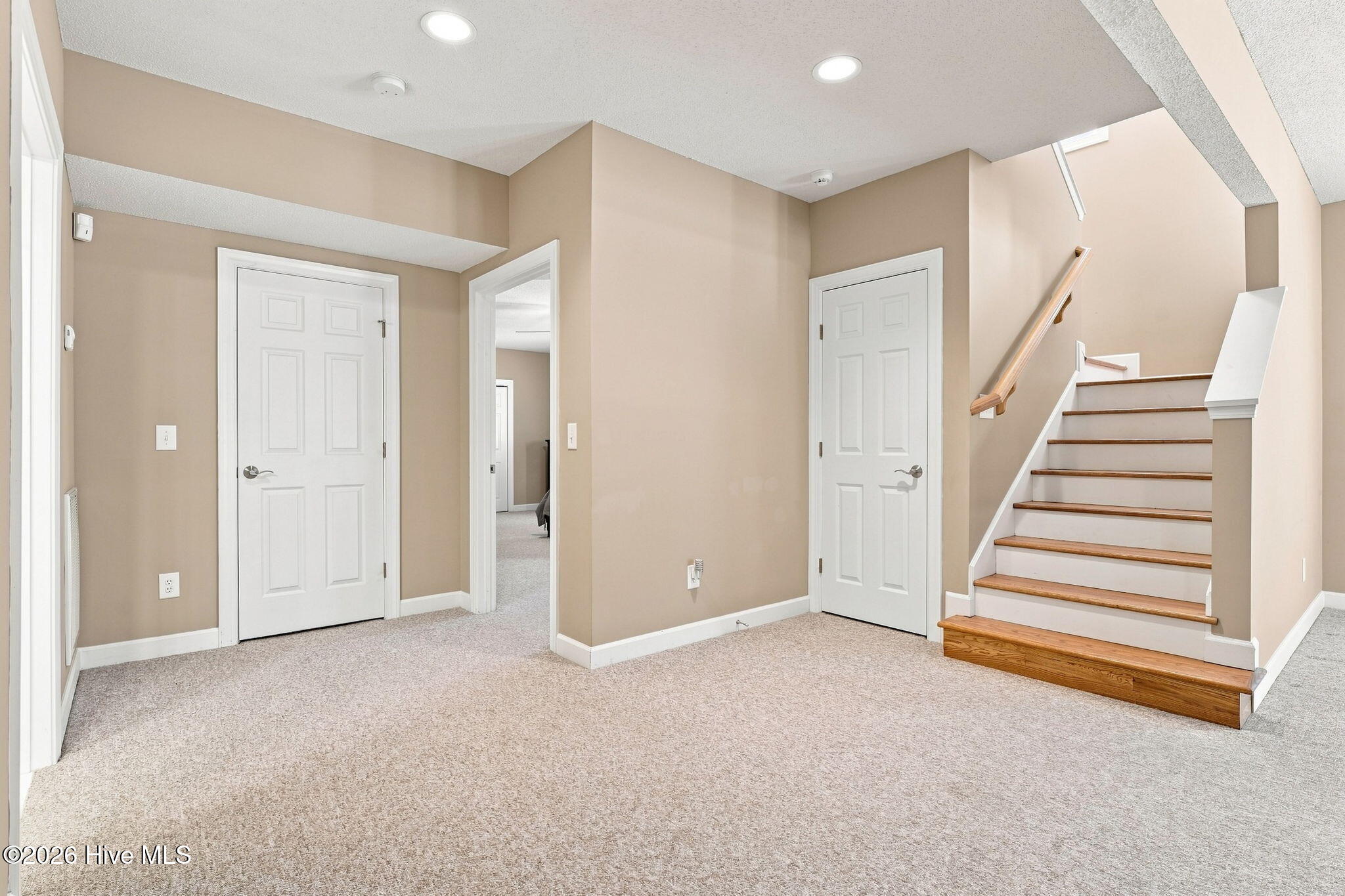 30 Lake View Drive E Property Photo 34