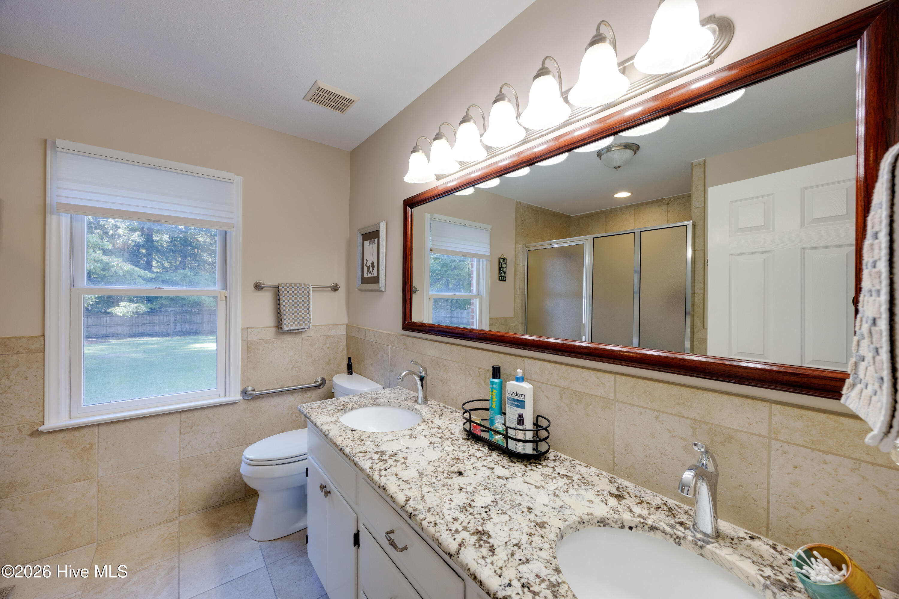 320 S Wedgewood Drive Property Photo 18