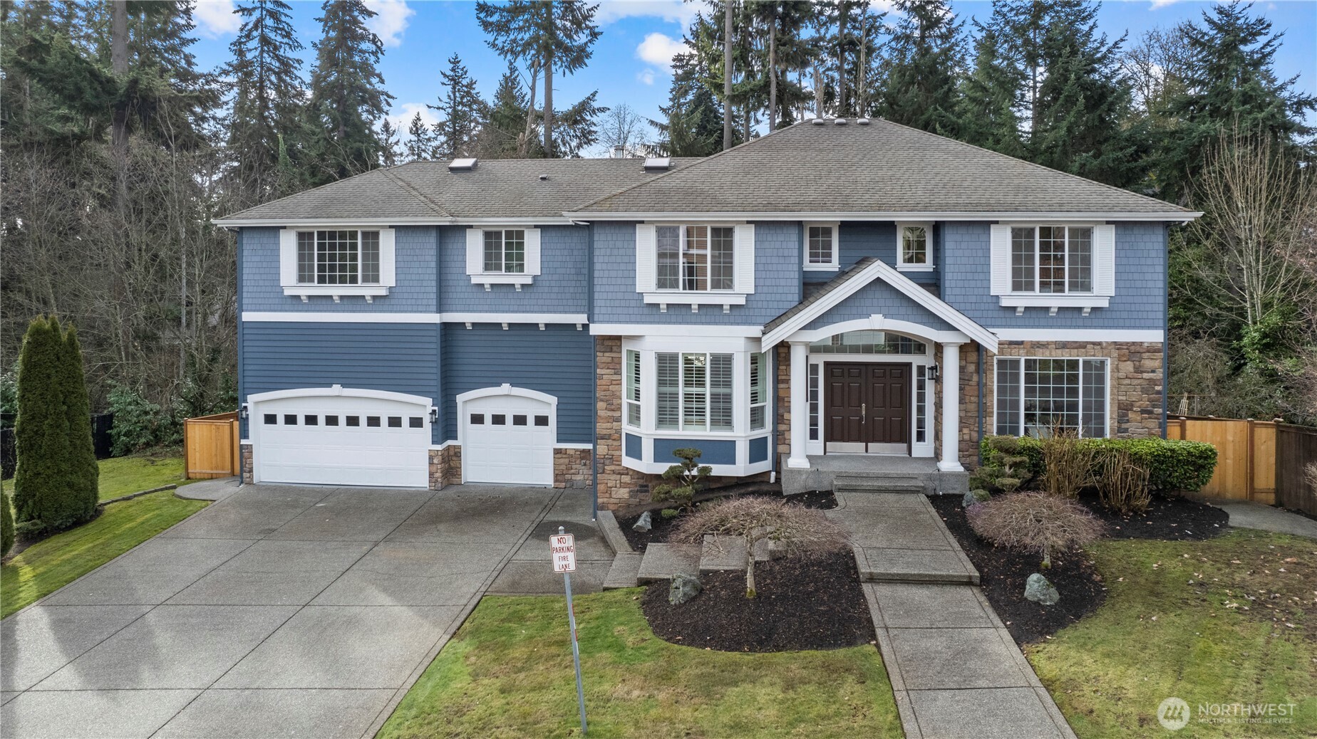 17915 33rd Place Property Photo