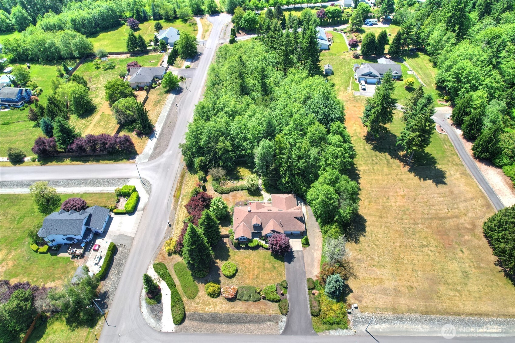 418 158th Place Property Photo 14