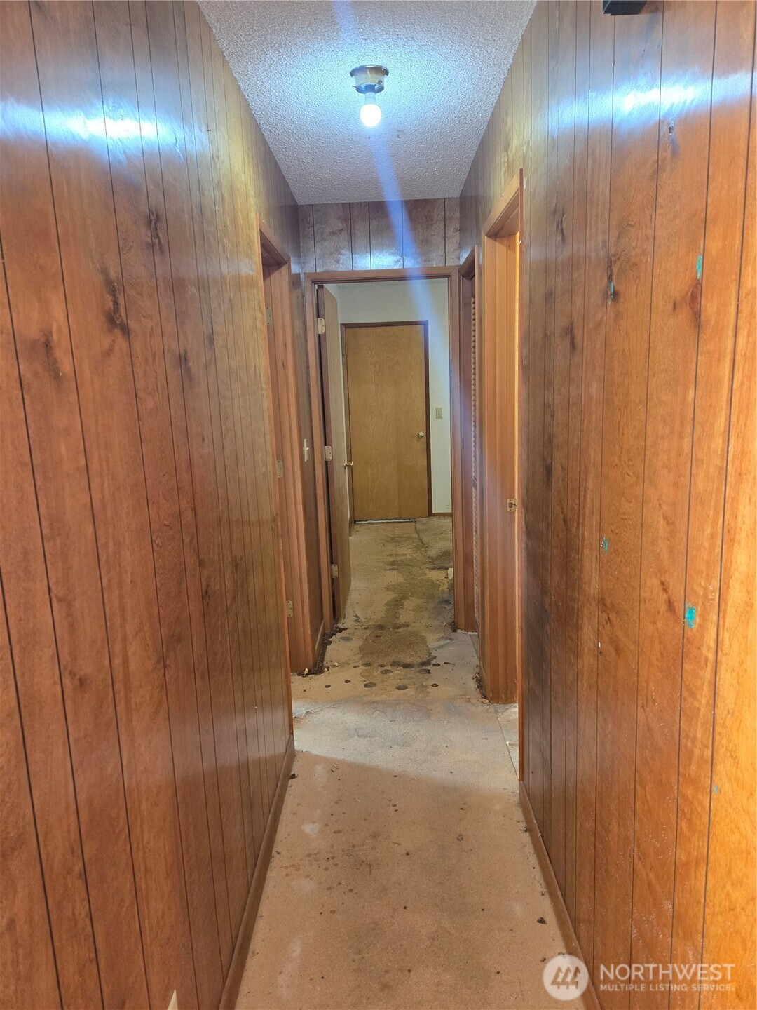 30011 J Place Property Photo 17