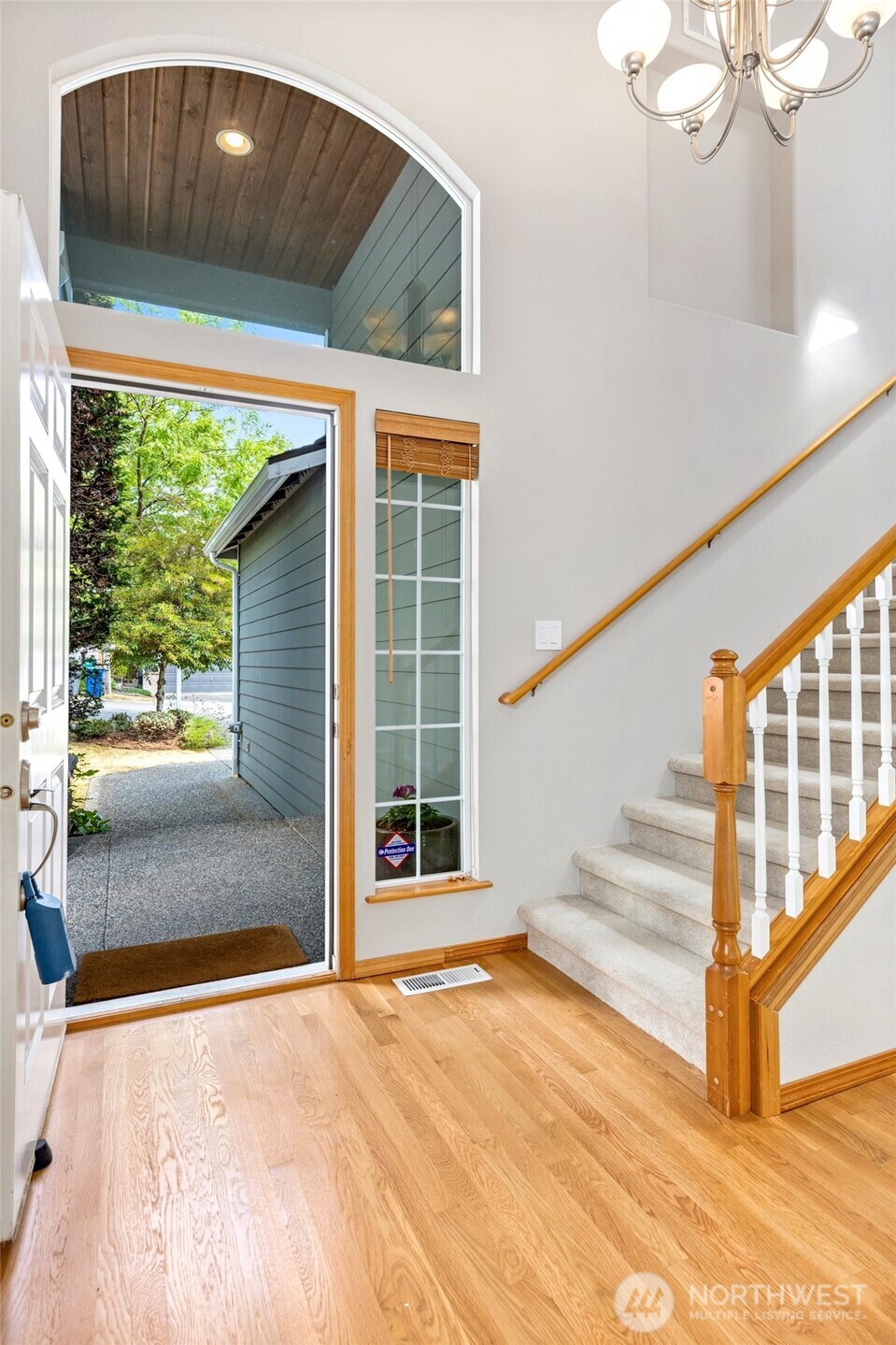 308 170th Place Property Photo 3