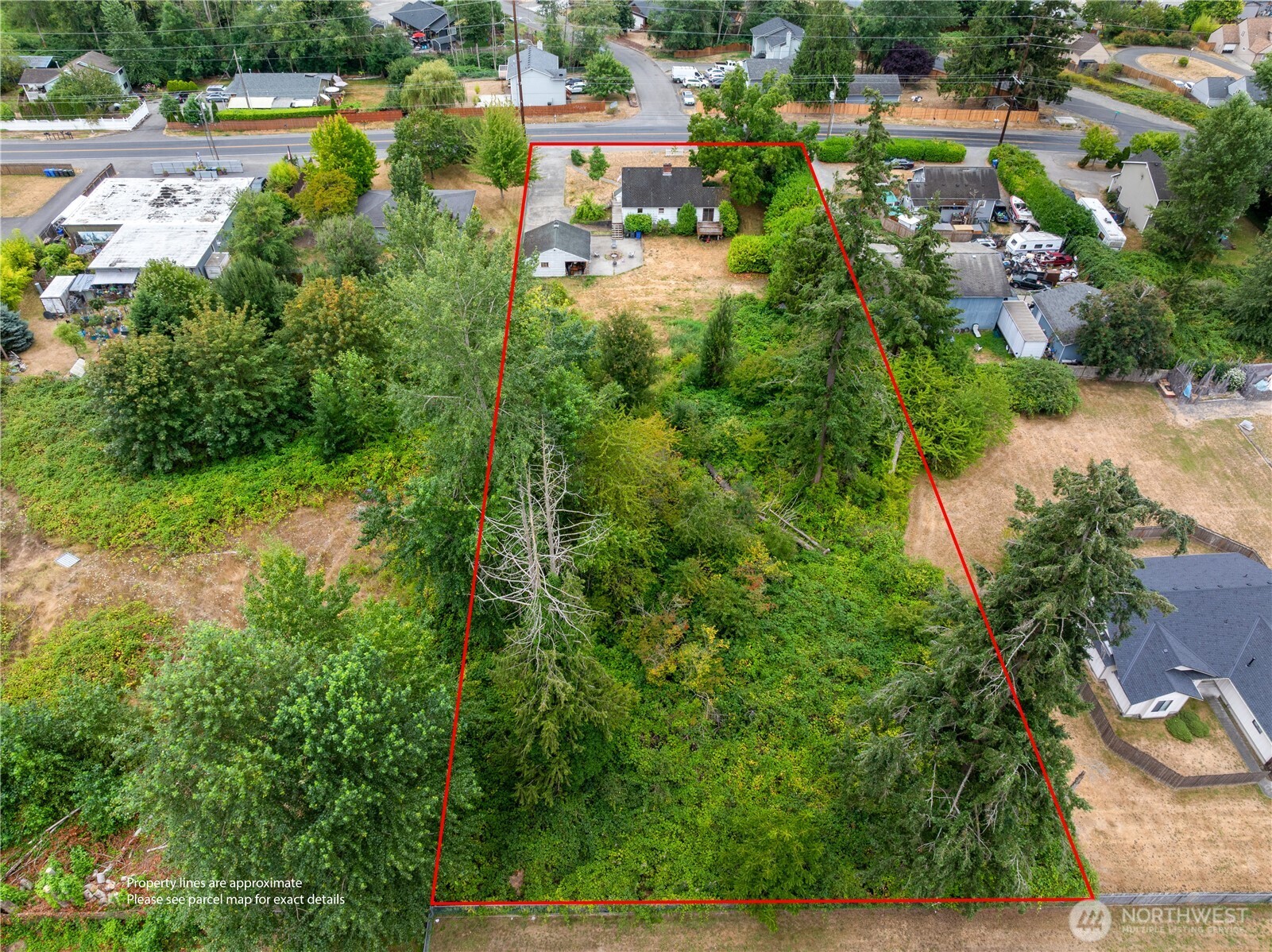 215 99th Street Property Photo 27