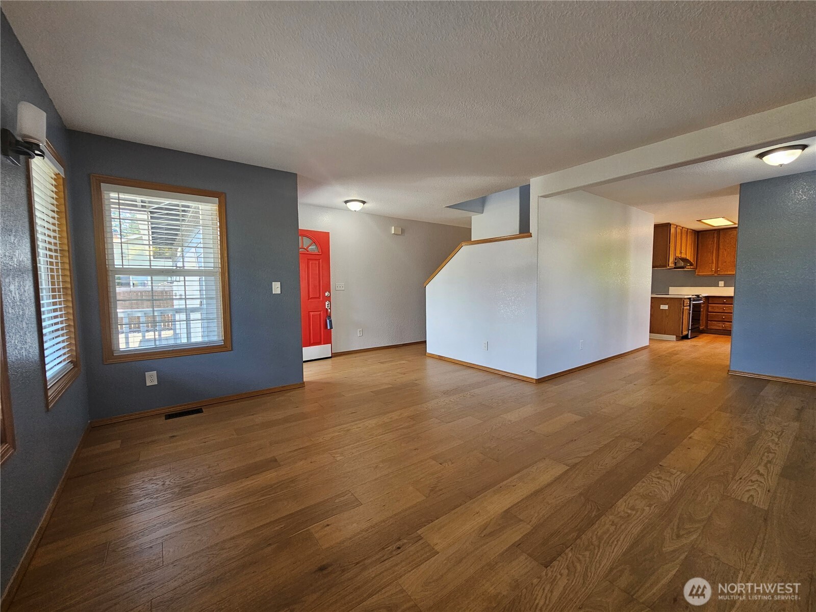 20414 2nd Avenue Property Photo 5