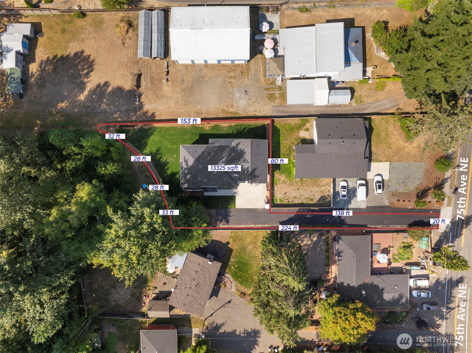20101 75th Avenue Property Photo 39