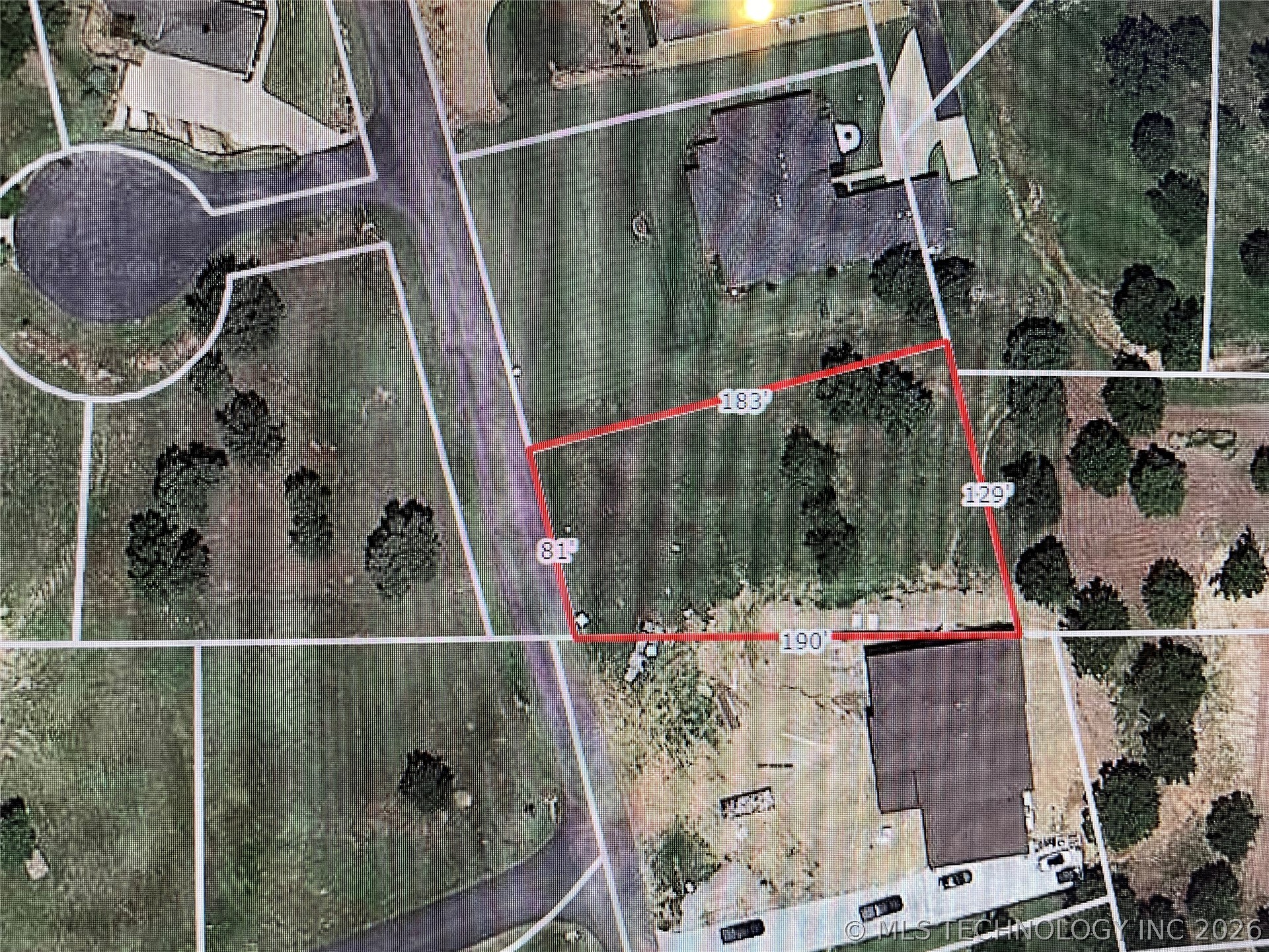 9 Shoreline Drive Property Photo 4